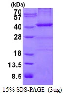 3microg Human Nucleophosmin protein (GTX67599-pro) by SDS-PAGE under reducing condition and visualized by coomassie blue stain. 3microg Human Nucleophosmin protein (GTX67599-pro) by SDS-PAGE under reducing condition and visualized by coomassie blue stain.