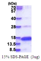 3microg Human Neurogranin protein (GTX67600-pro) by SDS-PAGE under reducing condition and visualized by coomassie blue stain. 3microg Human Neurogranin protein (GTX67600-pro) by SDS-PAGE under reducing condition and visualized by coomassie blue stain.