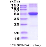 3microg Human ODC protein (GTX67603-pro) by SDS-PAGE under reducing condition and visualized by coomassie blue stain. 3microg Human ODC protein (GTX67603-pro) by SDS-PAGE under reducing condition and visualized by coomassie blue stain.