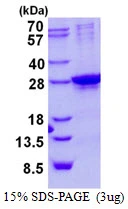 3microg Human SIX6 protein (GTX67605-pro) by SDS-PAGE under reducing condition and visualized by coomassie blue stain. 3microg Human SIX6 protein (GTX67605-pro) by SDS-PAGE under reducing condition and visualized by coomassie blue stain.