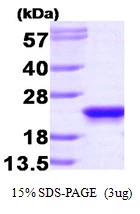 3microg Human RKIP protein (GTX67607-pro) by SDS-PAGE under reducing condition and visualized by coomassie blue stain. 3microg Human RKIP protein (GTX67607-pro) by SDS-PAGE under reducing condition and visualized by coomassie blue stain.