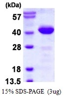 3microg Human PHLP protein (GTX67613-pro) by SDS-PAGE under reducing condition and visualized by coomassie blue stain. 3microg Human PHLP protein (GTX67613-pro) by SDS-PAGE under reducing condition and visualized by coomassie blue stain.