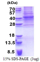 3microg Human PAX9 protein (GTX67614-pro) by SDS-PAGE under reducing condition and visualized by coomassie blue stain. 3microg Human PAX9 protein (GTX67614-pro) by SDS-PAGE under reducing condition and visualized by coomassie blue stain.