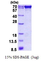 3microg Human PDZK1 protein (GTX67622-pro) by SDS-PAGE under reducing condition and visualized by coomassie blue stain. 3microg Human PDZK1 protein (GTX67622-pro) by SDS-PAGE under reducing condition and visualized by coomassie blue stain.