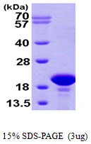 3microg Human PFDN2 protein (GTX67624-pro) by SDS-PAGE under reducing condition and visualized by coomassie blue stain.