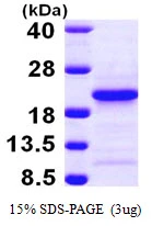 3microg Human PFDN4 protein (GTX67625-pro) by SDS-PAGE under reducing condition and visualized by coomassie blue stain. 3microg Human PFDN4 protein (GTX67625-pro) by SDS-PAGE under reducing condition and visualized by coomassie blue stain.