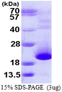3microg Human Prefoldin 5 protein (GTX67626-pro) by SDS-PAGE under reducing condition and visualized by coomassie blue stain.