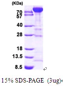 3microg Human PFKM protein (GTX67627-pro) by SDS-PAGE under reducing condition and visualized by coomassie blue stain.