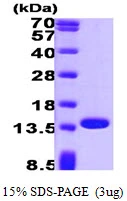 3microg Human Profilin 1 protein (GTX67628-pro) by SDS-PAGE under reducing condition and visualized by coomassie blue stain. 3microg Human Profilin 1 protein (GTX67628-pro) by SDS-PAGE under reducing condition and visualized by coomassie blue stain.