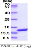3microg Human PMP2 protein (GTX67642-pro) by SDS-PAGE under reducing condition and visualized by coomassie blue stain. 3microg Human PMP2 protein (GTX67642-pro) by SDS-PAGE under reducing condition and visualized by coomassie blue stain.