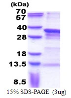 3microg Human PRRX1 protein (GTX67643-pro) by SDS-PAGE under reducing condition and visualized by coomassie blue stain.