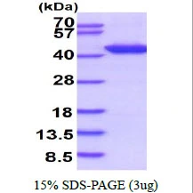 3&#956;g Human DNA polymerase beta protein (GTX67646-pro) by SDS-PAGE under reducing condition and visualized by coomassie blue stain.
