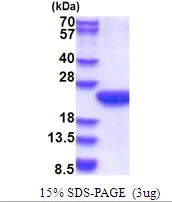 3microg Human POLR2F protein (GTX67650-pro) by SDS-PAGE under reducing condition and visualized by coomassie blue stain. 3microg Human POLR2F protein (GTX67650-pro) by SDS-PAGE under reducing condition and visualized by coomassie blue stain.
