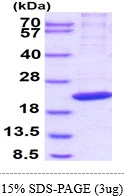 3microg Human RPB8 protein (GTX67651-pro) by SDS-PAGE under reducing condition and visualized by coomassie blue stain. 3microg Human RPB8 protein (GTX67651-pro) by SDS-PAGE under reducing condition and visualized by coomassie blue stain.