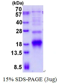 3microg Human POLR2I protein (GTX67652-pro) by SDS-PAGE under reducing condition and visualized by coomassie blue stain. 3microg Human POLR2I protein (GTX67652-pro) by SDS-PAGE under reducing condition and visualized by coomassie blue stain.