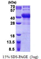 3microg Human POU6F1 protein (GTX67657-pro) by SDS-PAGE under reducing condition and visualized by coomassie blue stain. 3microg Human POU6F1 protein (GTX67657-pro) by SDS-PAGE under reducing condition and visualized by coomassie blue stain.