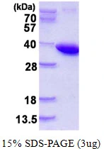 3microg Human PPA1 protein (GTX67658-pro) by SDS-PAGE under reducing condition and visualized by coomassie blue stain. 3microg Human PPA1 protein (GTX67658-pro) by SDS-PAGE under reducing condition and visualized by coomassie blue stain.