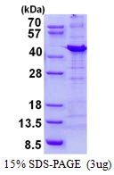 3microg Human NIPP1 protein (GTX67662-pro) by SDS-PAGE under reducing condition and visualized by coomassie blue stain. 3microg Human NIPP1 protein (GTX67662-pro) by SDS-PAGE under reducing condition and visualized by coomassie blue stain.
