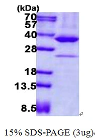 3microg Human AMPK beta 2 protein (GTX67669-pro) by SDS-PAGE under reducing condition and visualized by coomassie blue stain. 3microg Human AMPK beta 2 protein (GTX67669-pro) by SDS-PAGE under reducing condition and visualized by coomassie blue stain.