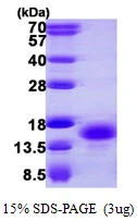 3microg Human PKIB protein (GTX67672-pro) by SDS-PAGE under reducing condition and visualized by coomassie blue stain. 3microg Human PKIB protein (GTX67672-pro) by SDS-PAGE under reducing condition and visualized by coomassie blue stain.