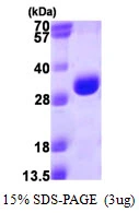 3microg Human PSMA3 protein (GTX67691-pro) by SDS-PAGE under reducing condition and visualized by coomassie blue stain. 3microg Human PSMA3 protein (GTX67691-pro) by SDS-PAGE under reducing condition and visualized by coomassie blue stain.