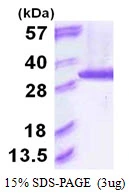 3microg Human PSMA6 protein (GTX67694-pro) by SDS-PAGE under reducing condition and visualized by coomassie blue stain.