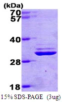 3microg Human PSMA7 protein (GTX67695-pro) by SDS-PAGE under reducing condition and visualized by coomassie blue stain. 3microg Human PSMA7 protein (GTX67695-pro) by SDS-PAGE under reducing condition and visualized by coomassie blue stain.
