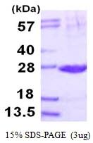 3microg Human PSMB2 protein (GTX67696-pro) by SDS-PAGE under reducing condition and visualized by coomassie blue stain. 3microg Human PSMB2 protein (GTX67696-pro) by SDS-PAGE under reducing condition and visualized by coomassie blue stain.