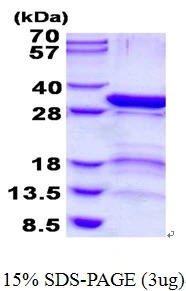 3microg Human PSMD9 protein (GTX67699-pro) by SDS-PAGE under reducing condition and visualized by coomassie blue stain. 3microg Human PSMD9 protein (GTX67699-pro) by SDS-PAGE under reducing condition and visualized by coomassie blue stain.