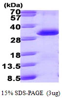 3microg Human PSME1 protein (GTX67703-pro) by SDS-PAGE under reducing condition and visualized by coomassie blue stain. 3microg Human PSME1 protein (GTX67703-pro) by SDS-PAGE under reducing condition and visualized by coomassie blue stain.