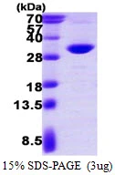 3microg Human PSME2 protein (GTX67704-pro) by SDS-PAGE under reducing condition and visualized by coomassie blue stain. 3microg Human PSME2 protein (GTX67704-pro) by SDS-PAGE under reducing condition and visualized by coomassie blue stain.