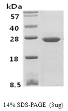 3microg Human PSPH protein (GTX67705-pro) by SDS-PAGE under reducing condition and visualized by coomassie blue stain. 3microg Human PSPH protein (GTX67705-pro) by SDS-PAGE under reducing condition and visualized by coomassie blue stain.