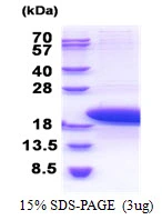3microg Human PTMS protein (GTX67709-pro) by SDS-PAGE under reducing condition and visualized by coomassie blue stain. 3microg Human PTMS protein (GTX67709-pro) by SDS-PAGE under reducing condition and visualized by coomassie blue stain.