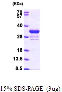 3microg Human Rad1 protein (GTX67713-pro) by SDS-PAGE under reducing condition and visualized by coomassie blue stain. 3microg Human Rad1 protein (GTX67713-pro) by SDS-PAGE under reducing condition and visualized by coomassie blue stain.