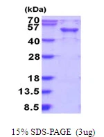3microg Human RAB3IL1 protein (GTX67723-pro) by SDS-PAGE under reducing condition and visualized by coomassie blue stain. 3microg Human RAB3IL1 protein (GTX67723-pro) by SDS-PAGE under reducing condition and visualized by coomassie blue stain.