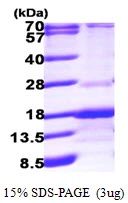 3microg Human RABIF protein (GTX67730-pro) by SDS-PAGE under reducing condition and visualized by coomassie blue stain. 3microg Human RABIF protein (GTX67730-pro) by SDS-PAGE under reducing condition and visualized by coomassie blue stain.