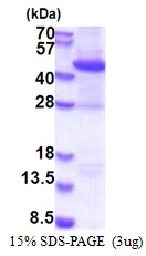 3microg Human Rad51B protein (GTX67735-pro) by SDS-PAGE under reducing condition and visualized by coomassie blue stain. 3microg Human Rad51B protein (GTX67735-pro) by SDS-PAGE under reducing condition and visualized by coomassie blue stain.