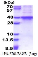 3microg Human Rad51D protein (GTX67736-pro) by SDS-PAGE under reducing condition and visualized by coomassie blue stain. 3microg Human Rad51D protein (GTX67736-pro) by SDS-PAGE under reducing condition and visualized by coomassie blue stain.