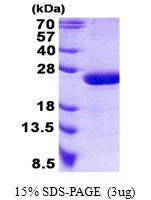 3microg Human RAP2B protein (GTX67740-pro) by SDS-PAGE under reducing condition and visualized by coomassie blue stain. 3microg Human RAP2B protein (GTX67740-pro) by SDS-PAGE under reducing condition and visualized by coomassie blue stain.