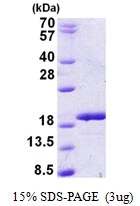 3microg Human RBM3 protein (GTX67742-pro) by SDS-PAGE under reducing condition and visualized by coomassie blue stain. 3microg Human RBM3 protein (GTX67742-pro) by SDS-PAGE under reducing condition and visualized by coomassie blue stain.