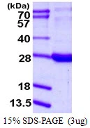 3microg Human RBP1 protein (GTX67743-pro) by SDS-PAGE under reducing condition and visualized by coomassie blue stain. 3microg Human RBP1 protein (GTX67743-pro) by SDS-PAGE under reducing condition and visualized by coomassie blue stain.