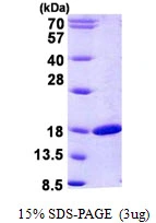 3microg Human RBP2 protein (GTX67744-pro) by SDS-PAGE under reducing condition and visualized by coomassie blue stain. 3microg Human RBP2 protein (GTX67744-pro) by SDS-PAGE under reducing condition and visualized by coomassie blue stain.