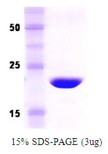 3microg Human Recoverin protein (GTX67745-pro) by SDS-PAGE under reducing condition and visualized by coomassie blue stain. 3microg Human Recoverin protein (GTX67745-pro) by SDS-PAGE under reducing condition and visualized by coomassie blue stain.