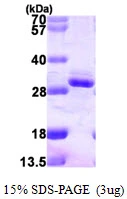 3microg Human RGS2 protein (GTX67747-pro) by SDS-PAGE under reducing condition and visualized by coomassie blue stain.