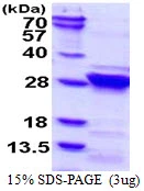 3microg Human RGS4 protein (GTX67748-pro) by SDS-PAGE under reducing condition and visualized by coomassie blue stain.