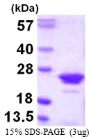 3microg Human RGS10 protein (GTX67749-pro) by SDS-PAGE under reducing condition and visualized by coomassie blue stain.