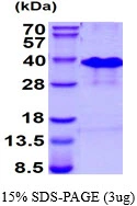 3microg Human RNF4 protein (GTX67753-pro) by SDS-PAGE under reducing condition and visualized by coomassie blue stain. 3microg Human RNF4 protein (GTX67753-pro) by SDS-PAGE under reducing condition and visualized by coomassie blue stain.