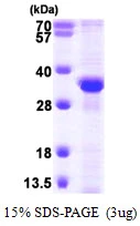 3microg Human RPA32 protein (GTX67754-pro) by SDS-PAGE under reducing condition and visualized by coomassie blue stain. 3microg Human RPA32 protein (GTX67754-pro) by SDS-PAGE under reducing condition and visualized by coomassie blue stain.