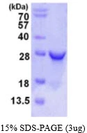 3microg Human RPE protein (GTX67755-pro) by SDS-PAGE under reducing condition and visualized by coomassie blue stain. 3microg Human RPE protein (GTX67755-pro) by SDS-PAGE under reducing condition and visualized by coomassie blue stain.