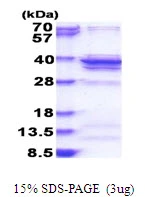 3microg Human RPL5 protein (GTX67756-pro) by SDS-PAGE under reducing condition and visualized by coomassie blue stain. 3microg Human RPL5 protein (GTX67756-pro) by SDS-PAGE under reducing condition and visualized by coomassie blue stain.
